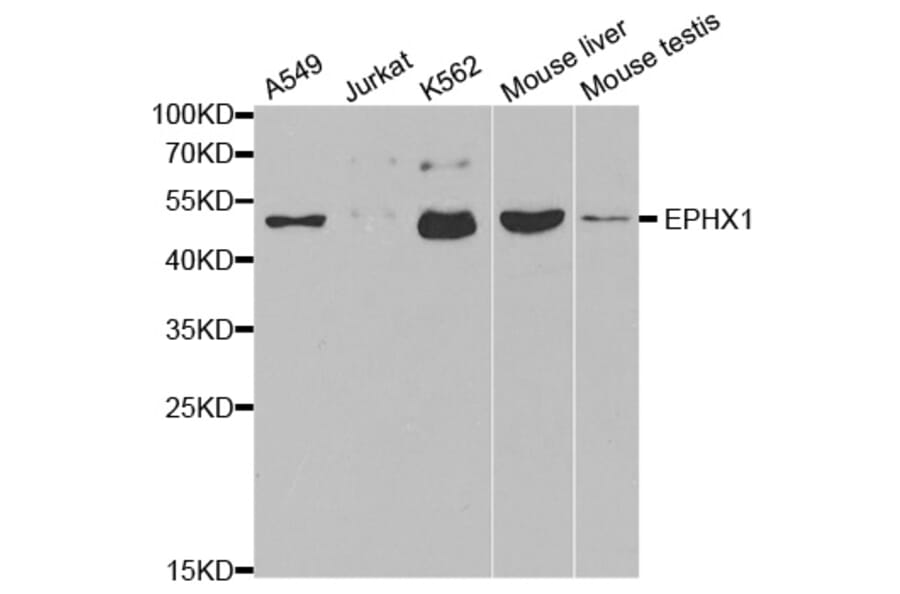 Western blot - EPHX1 Antibody from Signalway Antibody (32583) - Antibodies.com