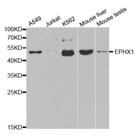 Western blot - EPHX1 Antibody from Signalway Antibody (32583) - Antibodies.com