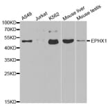 Western blot - EPHX1 Antibody from Signalway Antibody (32583) - Antibodies.com