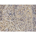Immunohistochemistry - EPHX1 Antibody from Signalway Antibody (32583) - Antibodies.com
