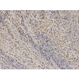 Immunohistochemistry - EPHX1 Antibody from Signalway Antibody (32583) - Antibodies.com