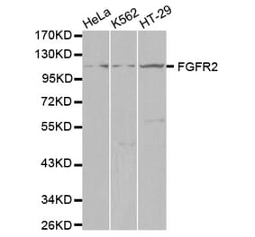 Western blot - FGFR2 Antibody from Signalway Antibody (32586) - Antibodies.com