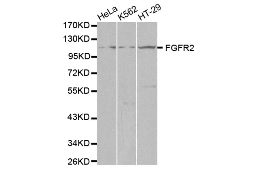 Western blot - FGFR2 Antibody from Signalway Antibody (32586) - Antibodies.com