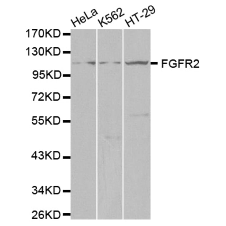 Western blot - FGFR2 Antibody from Signalway Antibody (32586) - Antibodies.com