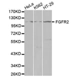 Western blot - FGFR2 Antibody from Signalway Antibody (32586) - Antibodies.com