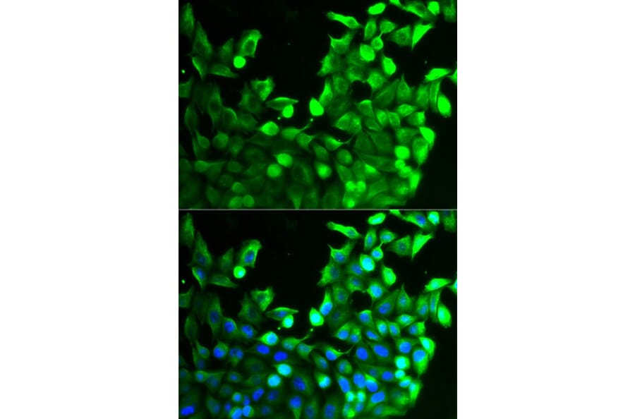 Immunofluorescence - FGFR2 Antibody from Signalway Antibody (32586) - Antibodies.com
