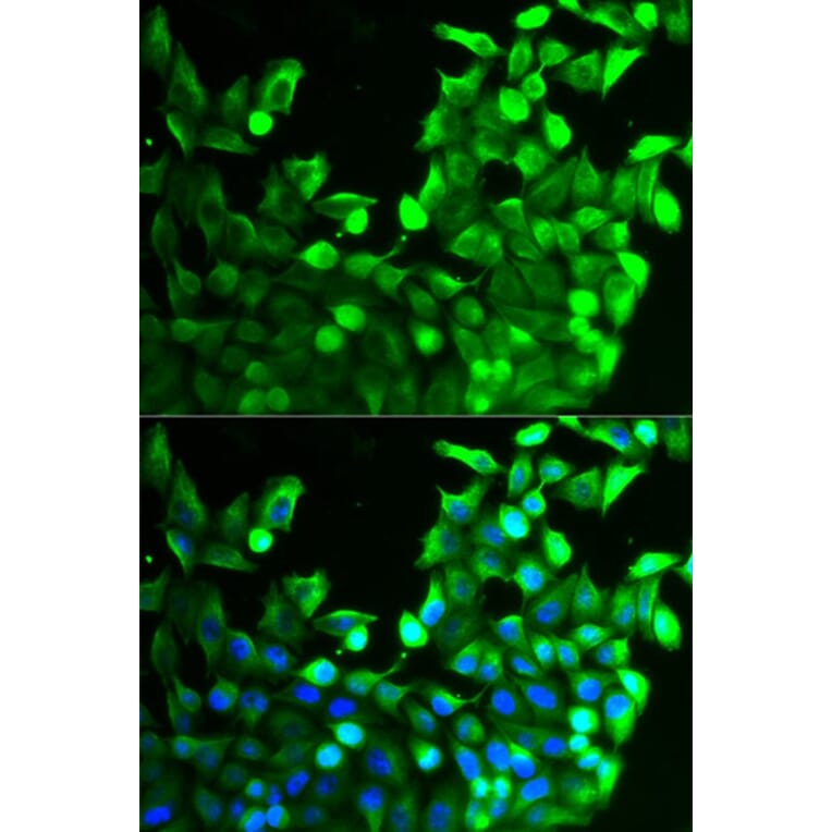 Immunofluorescence - FGFR2 Antibody from Signalway Antibody (32586) - Antibodies.com