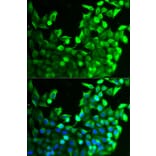 Immunofluorescence - FGFR2 Antibody from Signalway Antibody (32586) - Antibodies.com