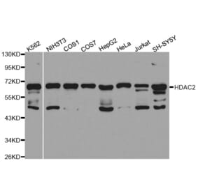 Western blot - HDAC2 Antibody from Signalway Antibody (32590) - Antibodies.com