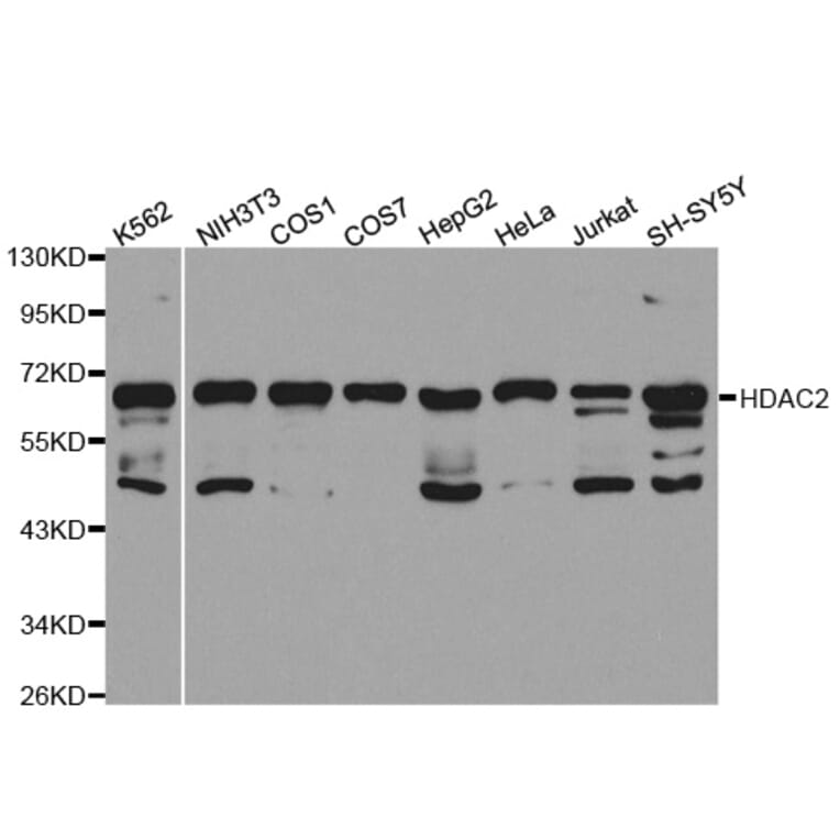 Western blot - HDAC2 Antibody from Signalway Antibody (32590) - Antibodies.com