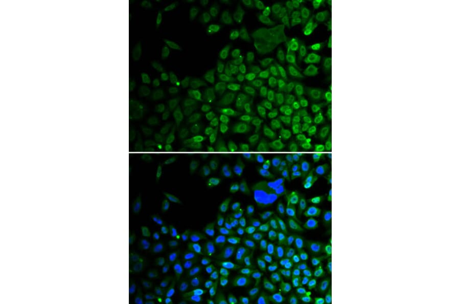 Immunofluorescence - HDAC2 Antibody from Signalway Antibody (32590) - Antibodies.com
