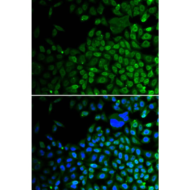 Immunofluorescence - HDAC2 Antibody from Signalway Antibody (32590) - Antibodies.com
