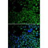 Immunofluorescence - HDAC2 Antibody from Signalway Antibody (32590) - Antibodies.com