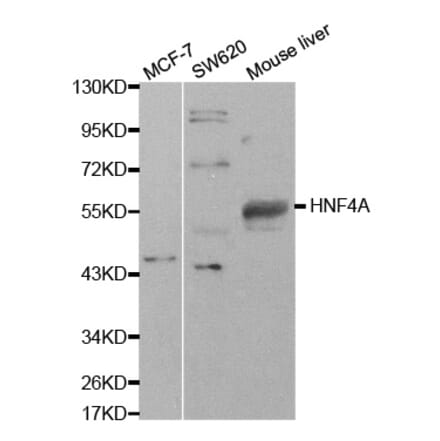 Western blot - HNF4A Antibody from Signalway Antibody (32591) - Antibodies.com