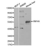 Western blot - HNF4A Antibody from Signalway Antibody (32591) - Antibodies.com