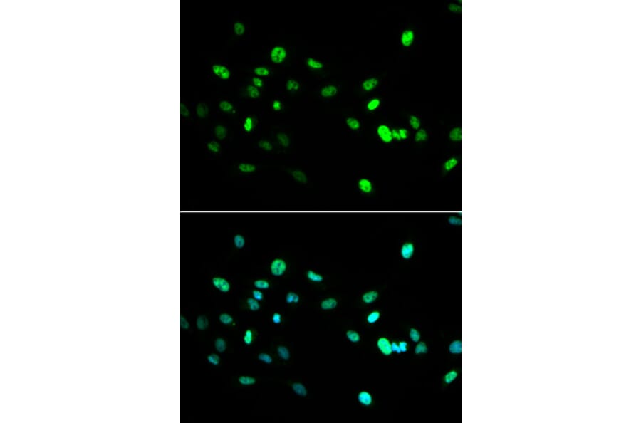 Immunofluorescence - HNF4A Antibody from Signalway Antibody (32591) - Antibodies.com