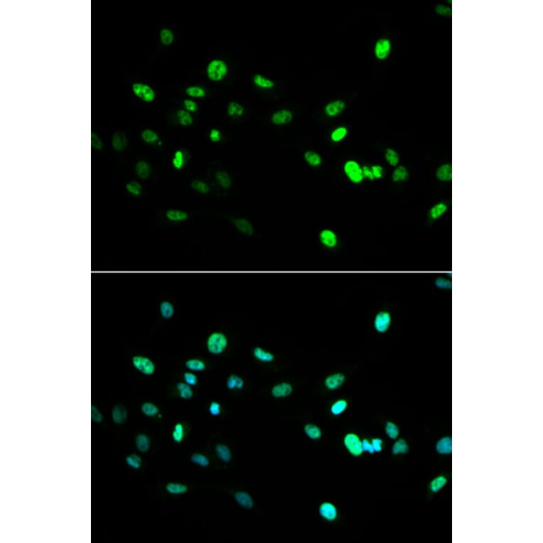Immunofluorescence - HNF4A Antibody from Signalway Antibody (32591) - Antibodies.com