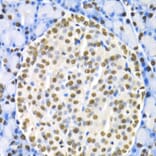 Immunohistochemistry - HNF4A Antibody from Signalway Antibody (32591) - Antibodies.com