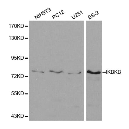 Western blot - IKBKB Antibody from Signalway Antibody (32593) - Antibodies.com