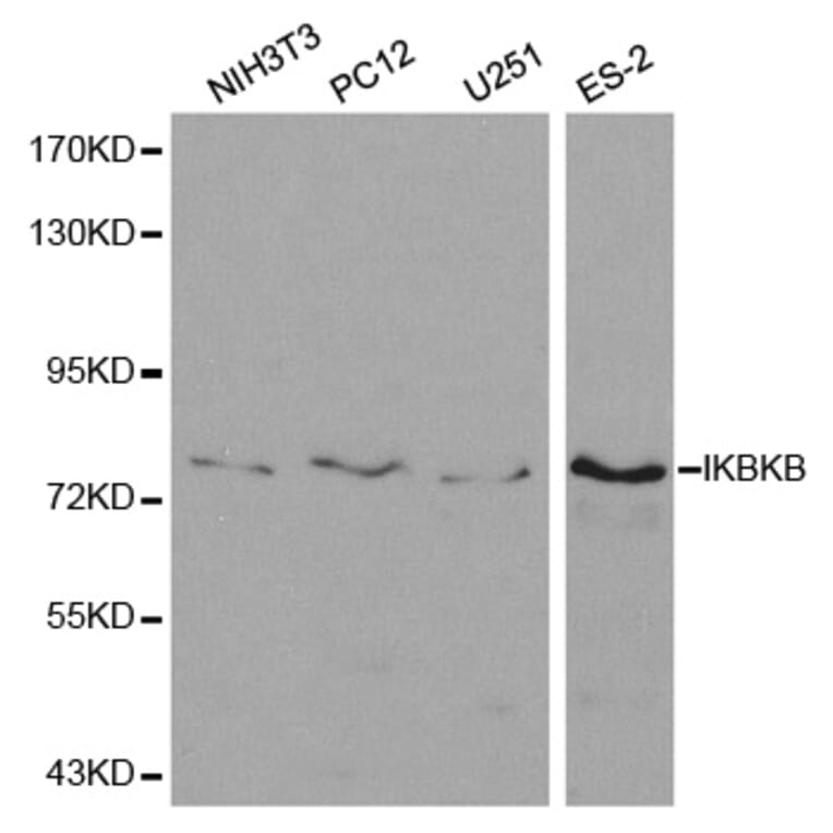Western blot - IKBKB Antibody from Signalway Antibody (32593) - Antibodies.com