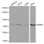 Western blot - IKBKB Antibody from Signalway Antibody (32593) - Antibodies.com