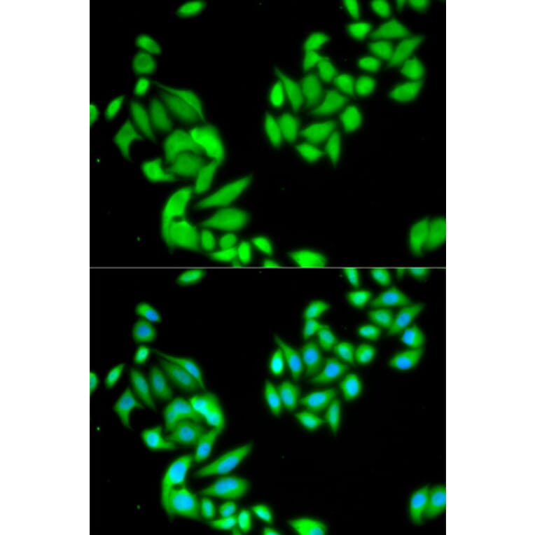 Immunofluorescence - IKBKB Antibody from Signalway Antibody (32593) - Antibodies.com