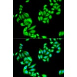 Immunofluorescence - IKBKB Antibody from Signalway Antibody (32593) - Antibodies.com