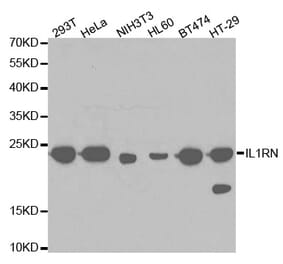 Western blot - IL1RN Antibody from Signalway Antibody (32594) - Antibodies.com