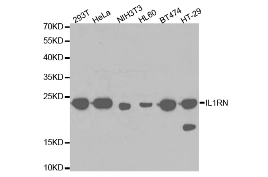 Western blot - IL1RN Antibody from Signalway Antibody (32594) - Antibodies.com