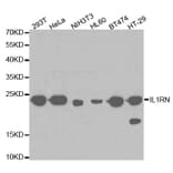 Western blot - IL1RN Antibody from Signalway Antibody (32594) - Antibodies.com