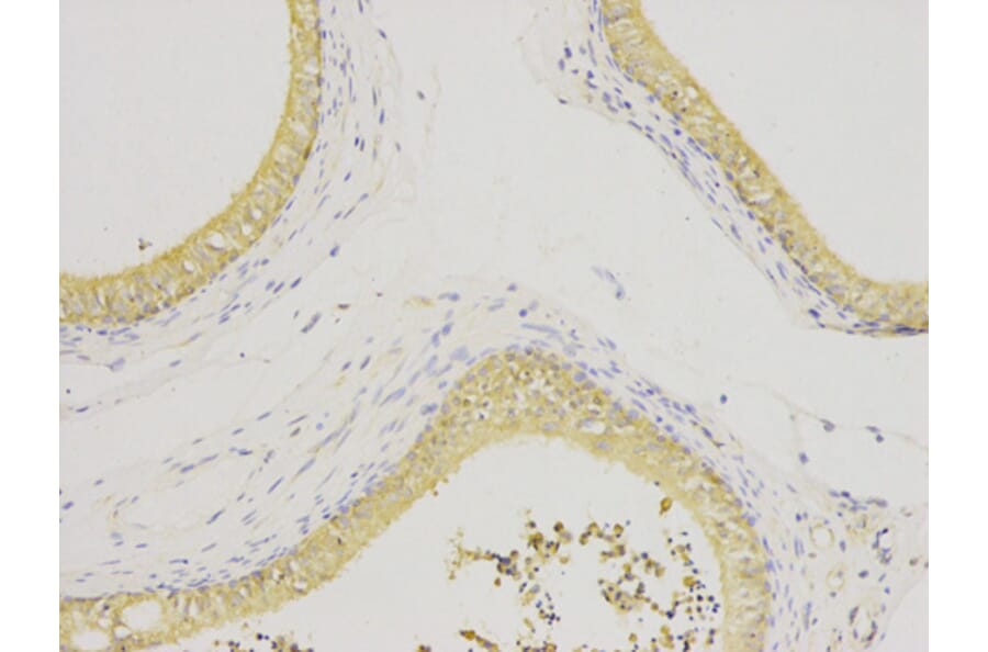 Immunohistochemistry - IL1RN Antibody from Signalway Antibody (32594) - Antibodies.com