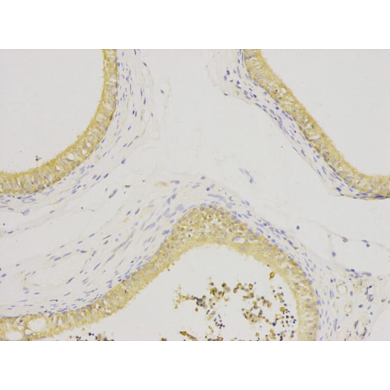 Immunohistochemistry - IL1RN Antibody from Signalway Antibody (32594) - Antibodies.com