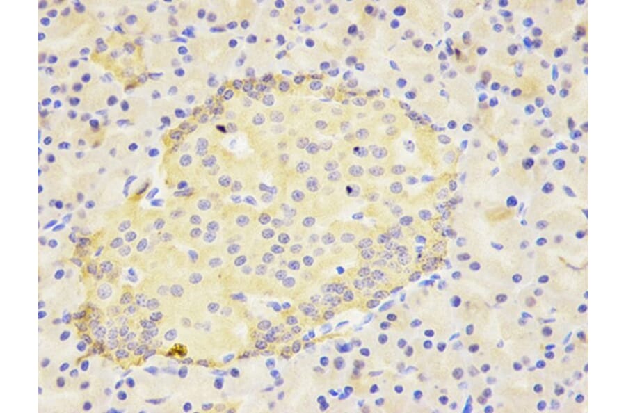 Immunohistochemistry - IL1RN Antibody from Signalway Antibody (32594) - Antibodies.com