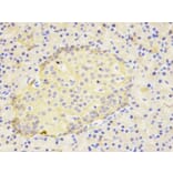 Immunohistochemistry - IL1RN Antibody from Signalway Antibody (32594) - Antibodies.com