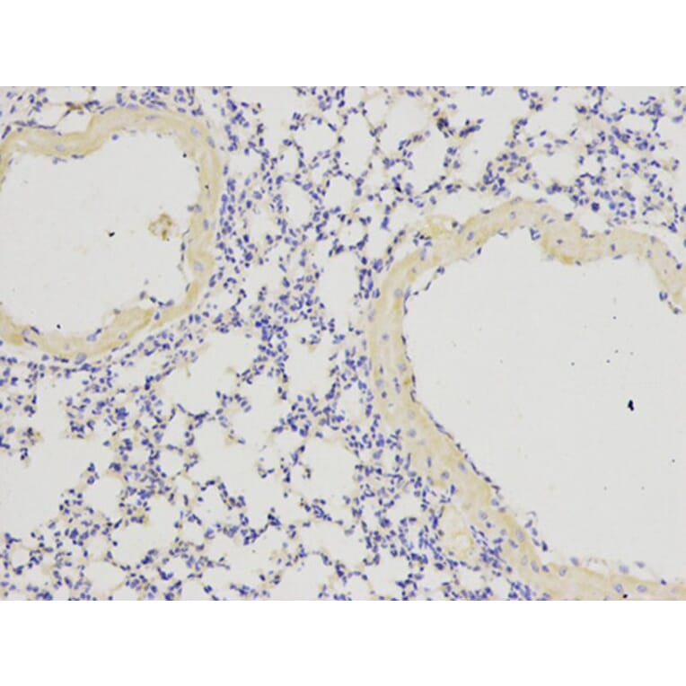 Immunohistochemistry - IL1RN Antibody from Signalway Antibody (32594) - Antibodies.com