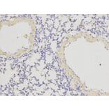 Immunohistochemistry - IL1RN Antibody from Signalway Antibody (32594) - Antibodies.com