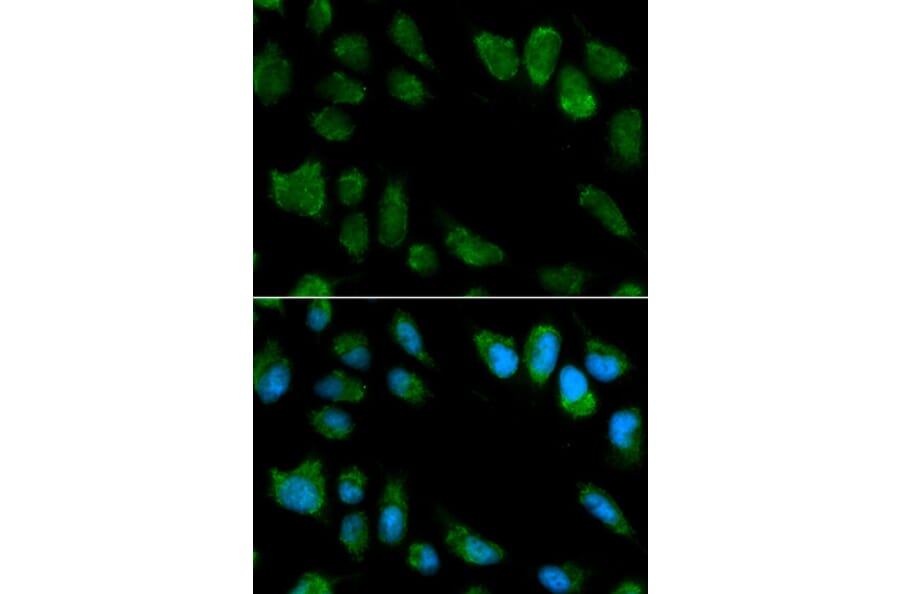 Immunofluorescence - IL1RN Antibody from Signalway Antibody (32594) - Antibodies.com