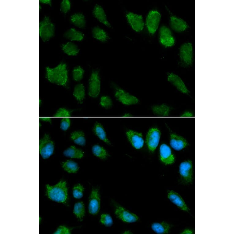 Immunofluorescence - IL1RN Antibody from Signalway Antibody (32594) - Antibodies.com