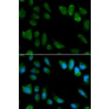 Immunofluorescence - IL1RN Antibody from Signalway Antibody (32594) - Antibodies.com