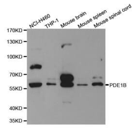 Western blot - PDE1B Antibody from Signalway Antibody (32598) - Antibodies.com