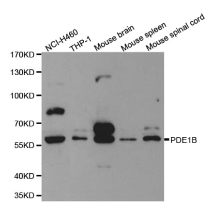 Western blot - PDE1B Antibody from Signalway Antibody (32598) - Antibodies.com