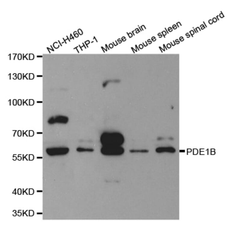 Western blot - PDE1B Antibody from Signalway Antibody (32598) - Antibodies.com