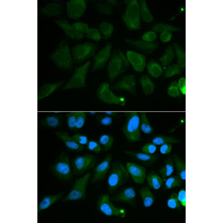 Immunofluorescence - PDE1B Antibody from Signalway Antibody (32598) - Antibodies.com