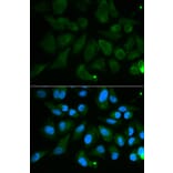Immunofluorescence - PDE1B Antibody from Signalway Antibody (32598) - Antibodies.com