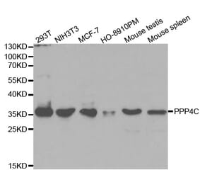Western blot - PPP4C Antibody from Signalway Antibody (32602) - Antibodies.com