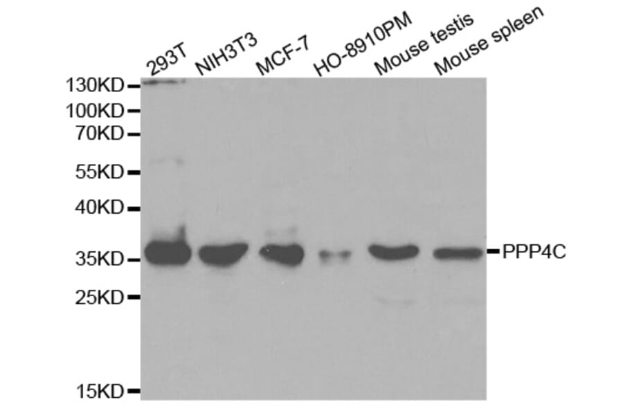 Western blot - PPP4C Antibody from Signalway Antibody (32602) - Antibodies.com