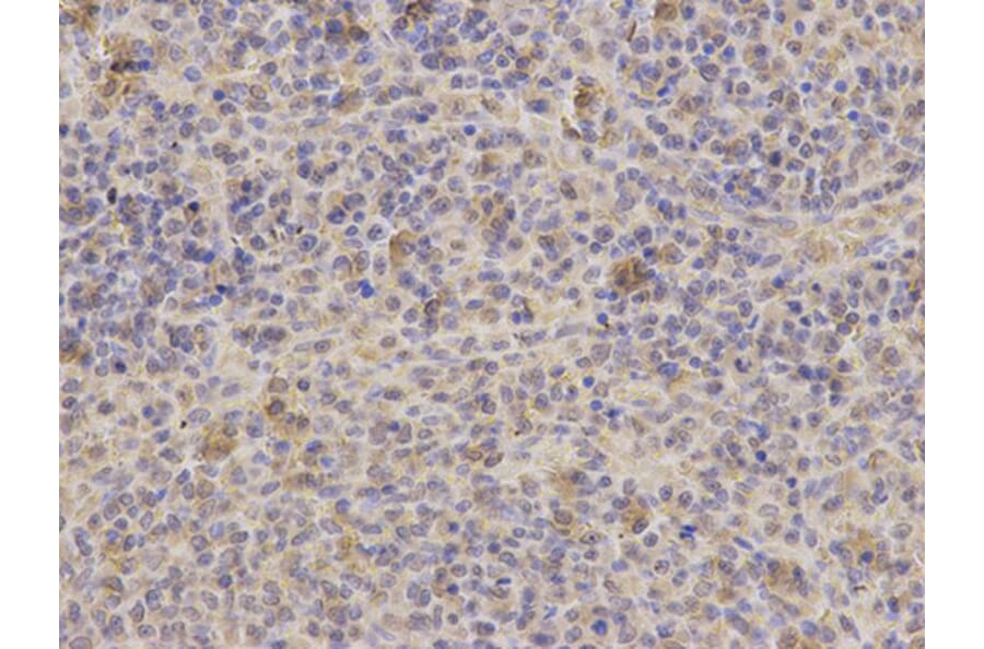 Immunohistochemistry - PPP4C Antibody from Signalway Antibody (32602) - Antibodies.com
