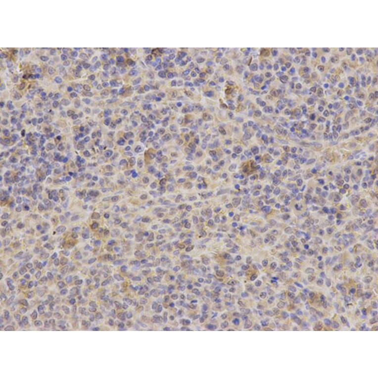 Immunohistochemistry - PPP4C Antibody from Signalway Antibody (32602) - Antibodies.com