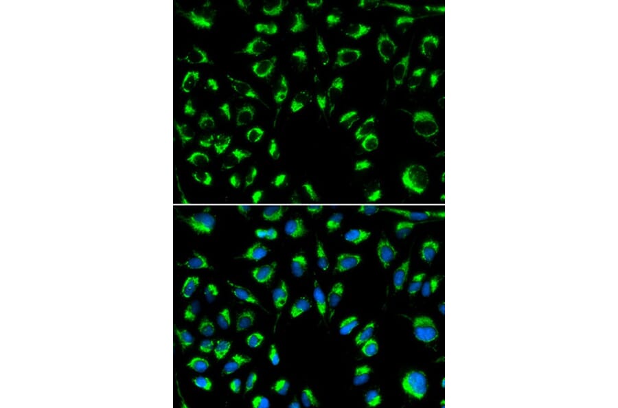 Immunofluorescence - PPP4C Antibody from Signalway Antibody (32602) - Antibodies.com
