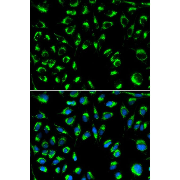 Immunofluorescence - PPP4C Antibody from Signalway Antibody (32602) - Antibodies.com